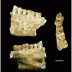 Beeswax as Dental Filling on a Neolithic Human Tooth
